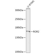 Western blot analysis of extracts of U-87MG cells using ROR2 Antibody (1/1000 dilution).