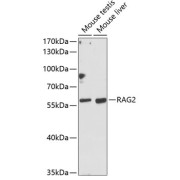 Western blot analysis of extracts of various cell lines using RAG2 Antibody (1/1000 dilution).