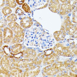Endothelin Converting Enzyme 1 (ECE1) Antibody