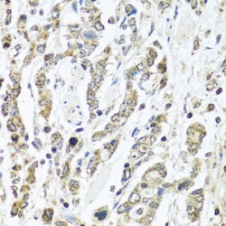 Interleukin 28B (IL28B) Antibody
