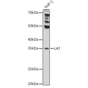 abx004320