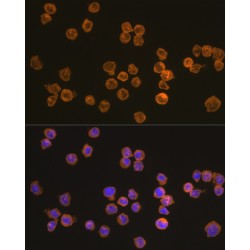 NACHT, LRR And PYD Domains-Containing Protein 3 (NLRP3) Antibody