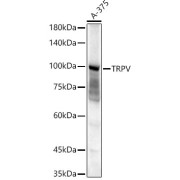 Western blot analysis of extracts of A-375 cells using TRPV Antibody (1/1500 dilution).