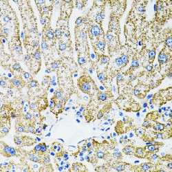 Erythropoietin (EPO) Antibody