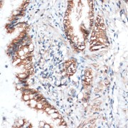 Immunohistochemistry of paraffin-embedded Rat lung using Aquaporin 4 Antibody (1/100 dilution, 40x lens).