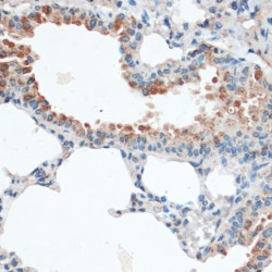 Aquaporin 4 (AQP4) Antibody