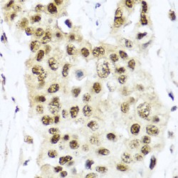 Methylcytosine Dioxygenase TET2 (TET2) Antibody