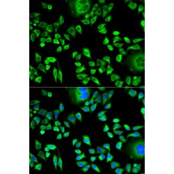Cystatin A (CSTA) Antibody