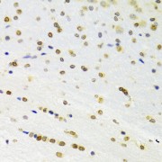 Immunohistochemistry of paraffin-embedded Rat brain using DOK1 Antibody (1/100 dilution, 40x lens).