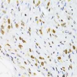 Docking Protein 1 (DOK1) Antibody