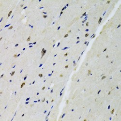 Docking Protein 1 (DOK1) Antibody