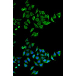 Docking Protein 1 (DOK1) Antibody