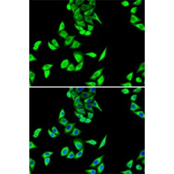 Fumarate Hydratase (FH) Antibody