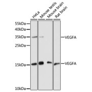 Western blot analysis of extracts of various cell lines using VEGFA Antibody (1/1000 dilution).
