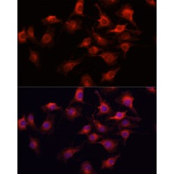 Vascular Endothelial Growth Factor A (VEGFA) Antibody