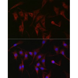 Protein Kinase C Zeta Type (PRKCZ) Antibody