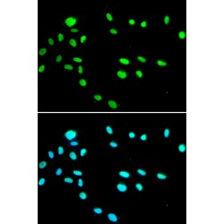 RuvB-Like 1/Pontin 52 (RUVBL1) Antibody