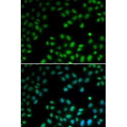 Protein Inhibitor of Activated STAT 1 (PIAS1) Antibody