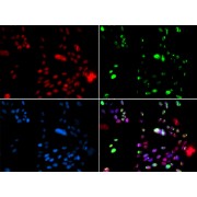 Immunofluorescence analysis of GFP-RNF168 transgenic U2OS cells using PIAS1 Antibody