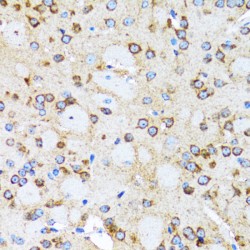 Actin-Related Protein 2 (ACTR2) Antibody