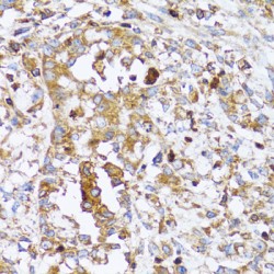 Actin-Related Protein 2 (ACTR2) Antibody