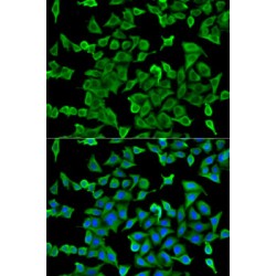 Actin-Related Protein 2 (ACTR2) Antibody