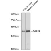 Western blot analysis of extracts of various cell lines using DAPK1 Antibody (1/1000 dilution).
