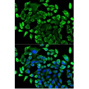 abx004398
