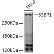 Western blot analysis of extracts of HeLa cells using 53BP1 Antibody (1/1000 dilution).