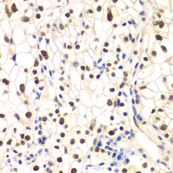 NF-kappa-B Inhibitor Beta (NFKBIB) Antibody