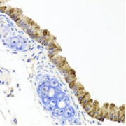 Immunohistochemistry of paraffin-embedded Mouse lung using TOPBP1 Antibody (1/100 dilution, 40x lens).