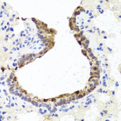 Topoisomerase II Binding Protein 1 (TOPBP1) Antibody