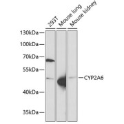 Western blot analysis of extracts of various cell lines using CYP2A6 Antibody (1/1000 dilution).