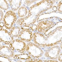 FAM82A2 Antibody