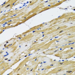 Aspartate Aminotransferase, Cytoplasmic / AST (GOT1) Antibody