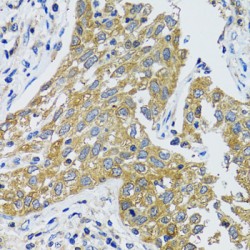 Aspartate Aminotransferase, Cytoplasmic / AST (GOT1) Antibody