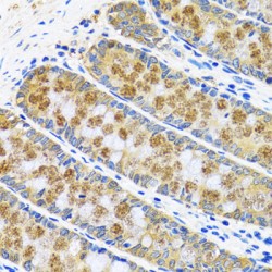 Aspartate Aminotransferase, Cytoplasmic / AST (GOT1) Antibody