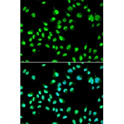 General Transcription Factor IIF, Polypeptide 2 (GTF2F2) Antibody