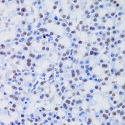 Bifunctional Arginine Demethylase And Lysyl-Hydroxylase JMJD6 (JMJD6) Antibody
