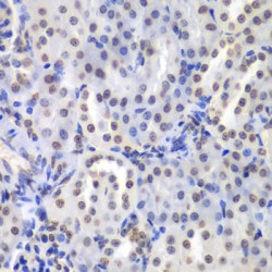 Protein Kinase C Beta (PRKCB) Antibody