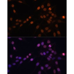 Protein Kinase C Beta (PRKCB) Antibody