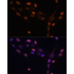 Protein Kinase C Beta (PRKCB) Antibody
