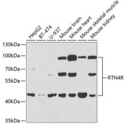Western blot analysis of extracts of various cell lines using RTN4R Antibody (1/1000 dilution).