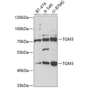 Western blot analysis of extracts of various cell lines using TGM3 Antibody (1/1000 dilution).