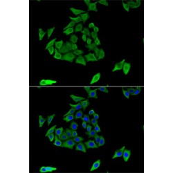 Transglutaminase 3, Epidermal (TGM3) Antibody