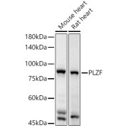 Western blot analysis of extracts of various cell lines using PLZF Antibody (1/2000 dilution).