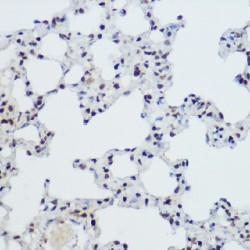 Zinc Finger And BTB Domain Containing 16 (ZBTB16) Antibody
