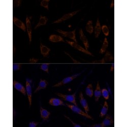 Transferrin Receptor Protein 1 / CD71 (TFRC) Antibody