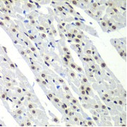 Immunohistochemistry of paraffin-embedded Rat heart using SF3B2 Antibody (1/100 dilution, 40x lens).