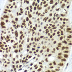 Splicing Factor 3B Subunit 2 (SF3B2) Antibody